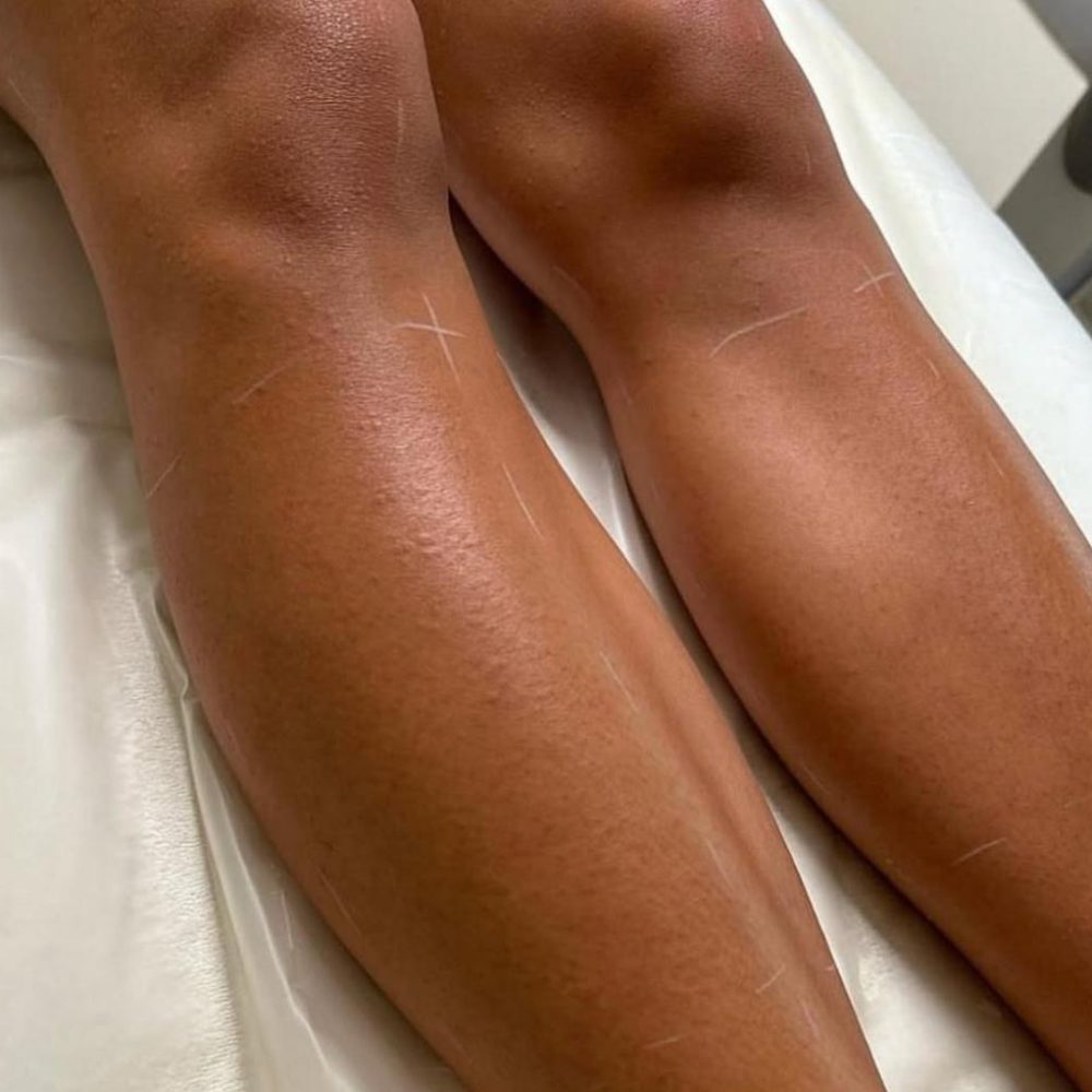 Skin Legs Rejouvination